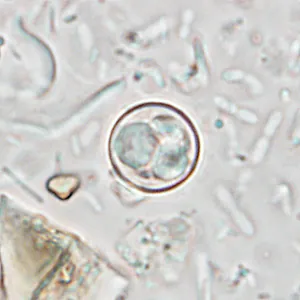 CDC diagnostic wet mount micrograph showing round Cyclospora cayetanensis organisms