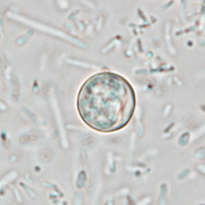 Microscopy image of Cyclospora cayetanensis oocysts requiring specialized stool testing