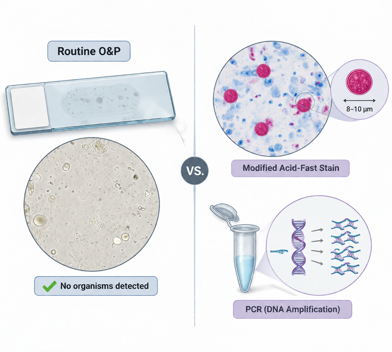 Comparison of routine ova-and-parasite examination with modified acid-fast staining and PCR for Cyclospora detection